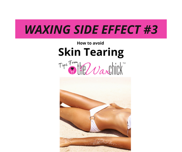 Waxing Side Effect #3  - Skin Tearing