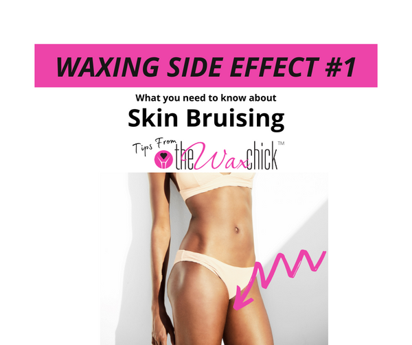 Waxing Side Effect #1 - Skin Bruising